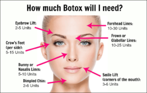 how much botox